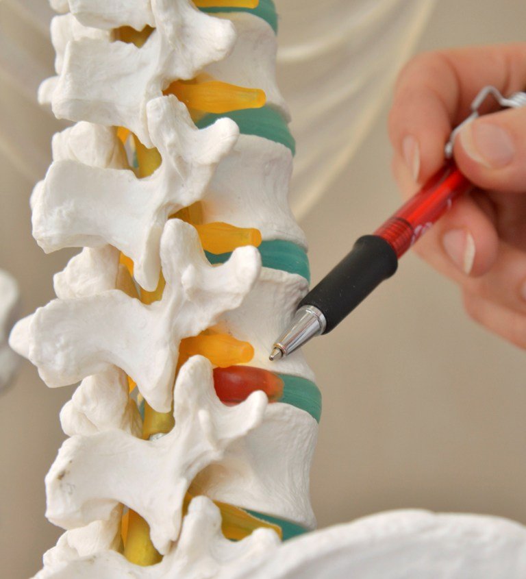 Schmerztagesklinik Weiden Rücken Wirbelsäule Symbol Symbolbild